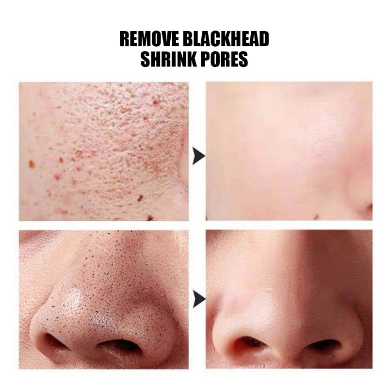 30pcs Face Cleaning Natural Silks Cocoons Blackhead Removal Exfoliating Silkworm