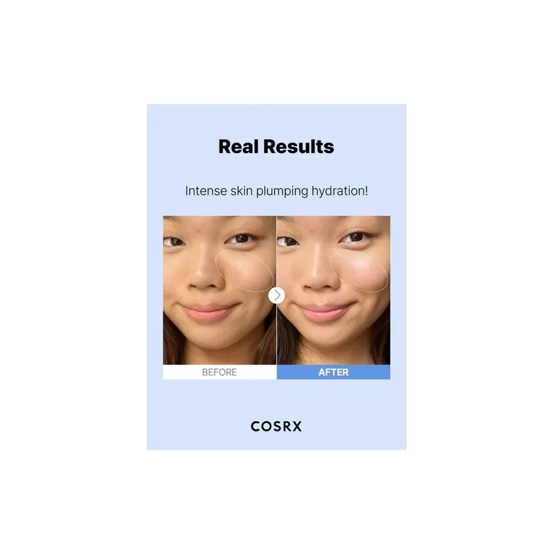 Cosrx The Hyaluronic Acid 3 Serum