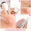 5PCS Blackhead Remover Comedone Extractor,Stainless Pimple Popper Tool，Curved Blackhead Tweezers