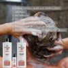 Nioxin Trio Shamp 1lt Acond 1lt Tratamiento 100ml Varios