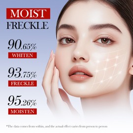 Rostblant Whitening Freckle Cream, Anti Aging Creme für Frauen, Aufhellende Sommersprossencreme, Anti-Freckle Und Hellt Die Haut Auf