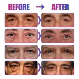 MANDALAY RETINOL EYES Tratamiento Contorno Ojos Retinol Colageno Elimina Bolsas 30