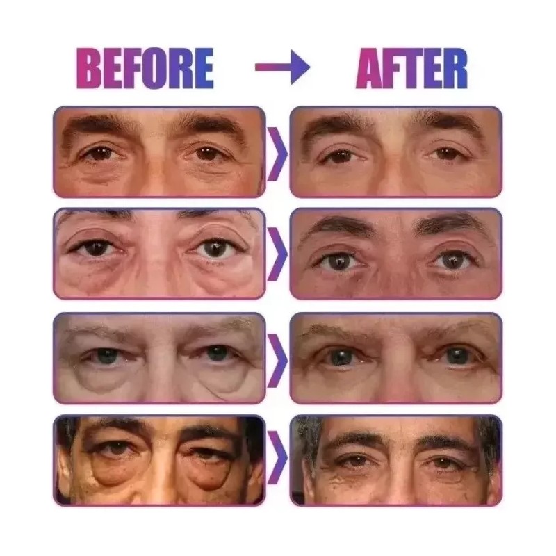 MANDALAY RETINOL EYES Tratamiento Contorno Ojos Retinol Colageno Elimina Bolsas