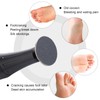 NMKL38 50PCS Replacement Sandpaper Discs Self-Adhesive 25mm with Stainless Steel
