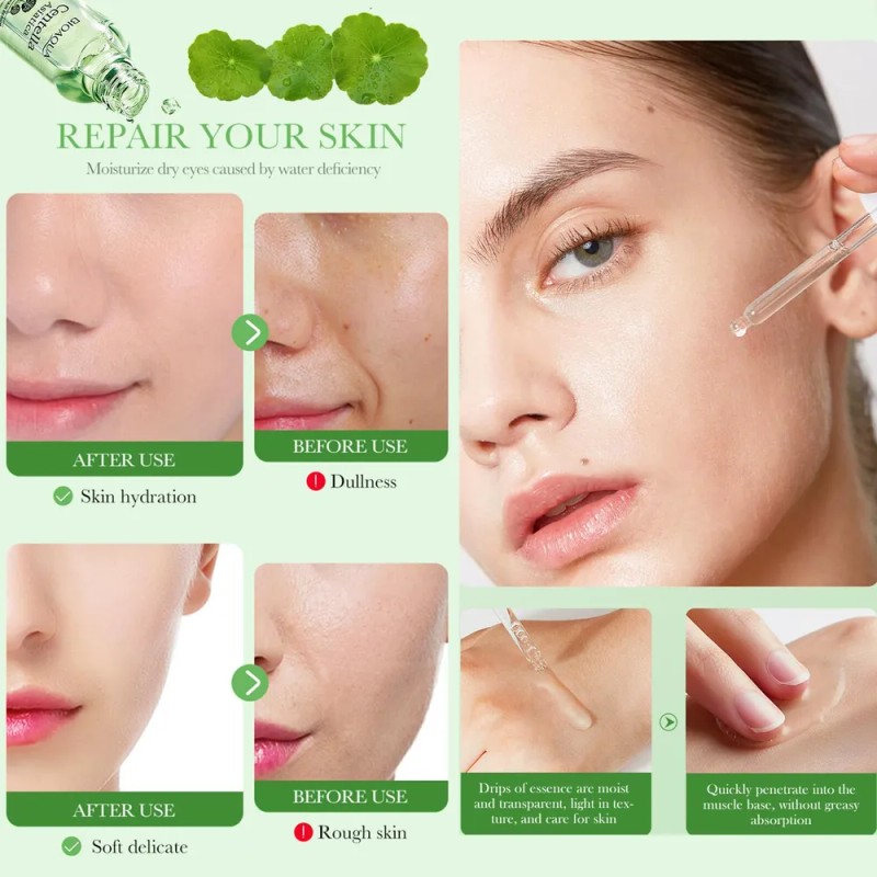 Serum Bioaqua Centella Asiatica Antiacn Control Grasa Todo Tipo De