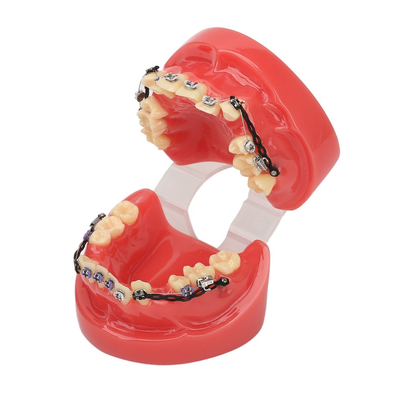 Professional Dental Demonstration Orthodontic Model with Metal Wires and Bracket
