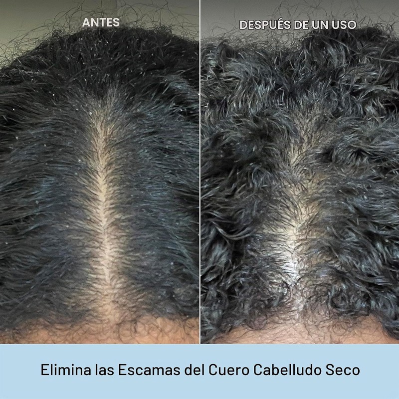 Briogeo- Champú microexfoliante con aceite de coco y carbón Scalp