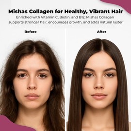 Multi Collagen Hair Pills - Biotin 10,000mcg, Keratin and Hyaluronic Acid - Hair Growth - hair skin and nails - DHT Blocking, Saw Palmetto, Vitamin E, Folic Acid, Pumpkin Seed, MSM - 60 Vegan Capsules