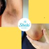 Aceite De Papa Shelo Reparador Para Piel Y Cabello 260
