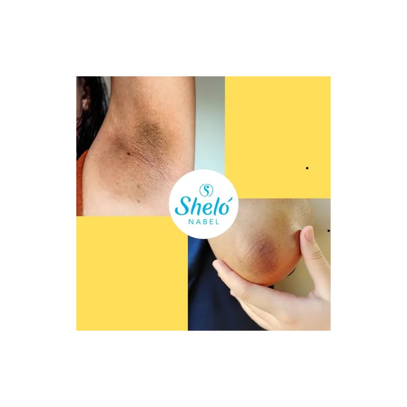 Aceite De Papa Shelo Reparador Para Piel Y Cabello 260