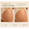 Natura Skin Oil 100ml Aceite Corporal Hidratante Estrías Cicatrices Rosa