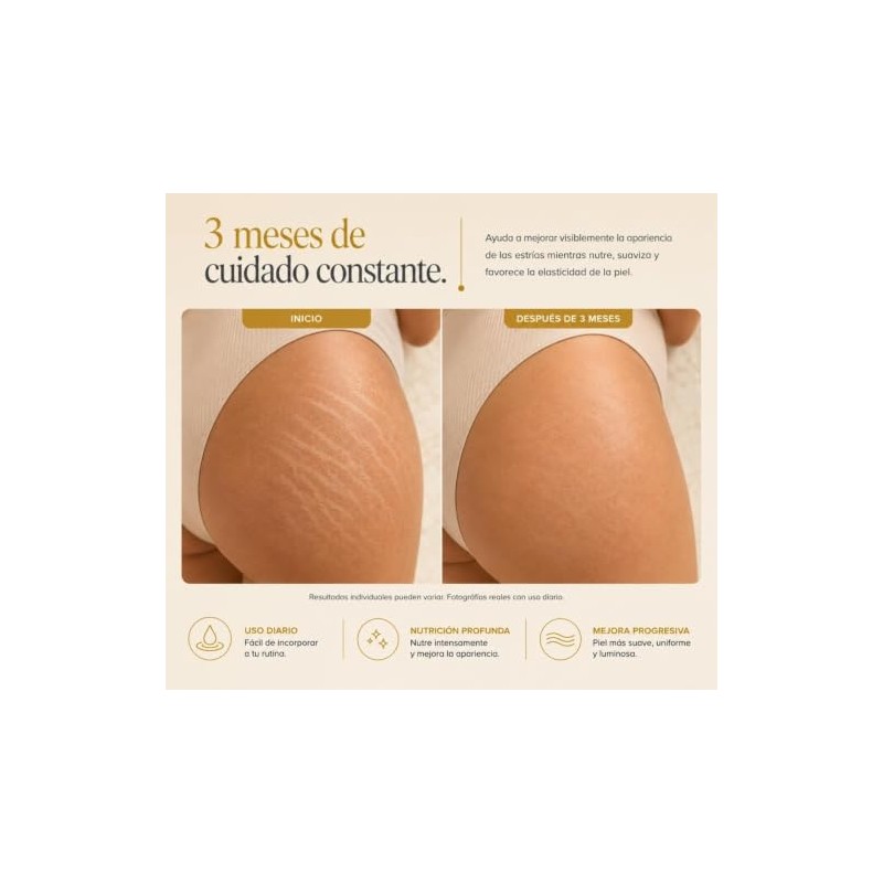 Natura Skin Oil 100ml Aceite Corporal Hidratante Estrías Cicatrices Rosa