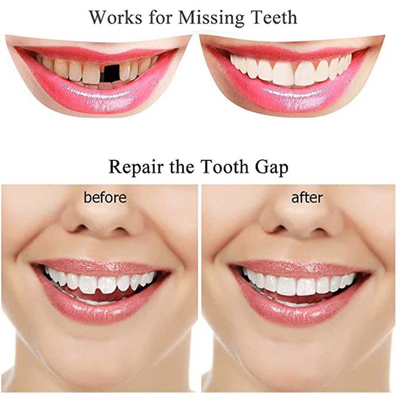 Denture Temporary Teeth Filling Kit Top and Bottom Fake Teeth,