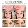 JAYSUING Organic Face Serum with Castor, Black Seed, Rosehip, and