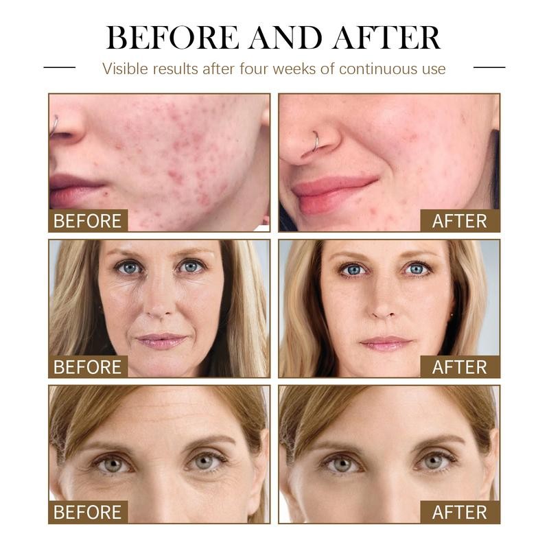 JAYSUING Organic Face Serum with Castor, Black Seed, Rosehip, and