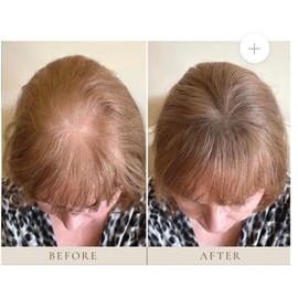 Plume INSTANT HAIRLINE SCALP-STICK Blonde Waterproof & Sweatproof Made In Canada