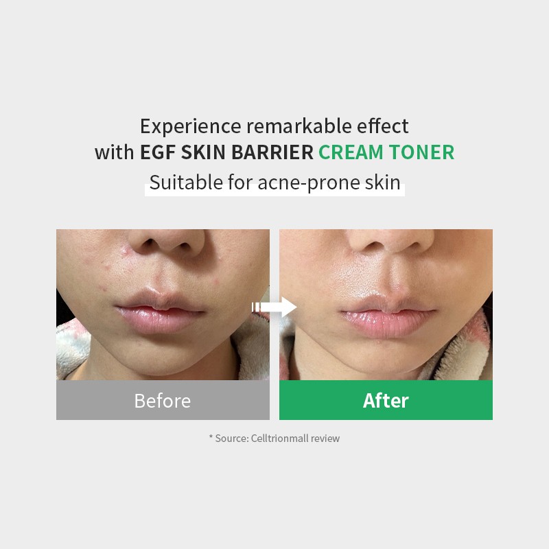 zipiderm [zipiderm]EGF Skin Barrier Cream Toner 150ml