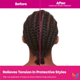 Matrix Instacure Tension Reliever Leave-In Scalp Serum | Moisturizes Dry, Irritated Scalp | Cools Tension in Braids, Protective & Tight Hairstyles | Packaging May Vary | 6.8 Fl. Oz. | Vegan