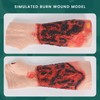 MedEduQuest Burn Wound Packing Trainer, Simulated Burn Wound Model for