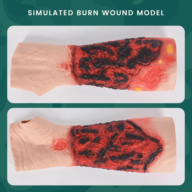 MedEduQuest Burn Wound Packing Trainer, Simulated Burn Wound Model for