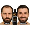 Shampoo Anticaída Hombre Fuerza Crecimiento Hombre 500ml mx
