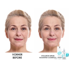 ROXUNITED Hyaluronic Serum High Dose "Comparison Winner" Face Anti-Ageing Hyaluronic Acid Serum Vegan Eyes, Vitamin C, Hyaluronic Serum Neck & Cleavage Face Serum (30 ml)