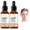Vitamina C Facial Serum - Face Serum for Women, Intense