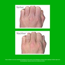 O'Keeffe's Working Hands 96 g Jar - Hand Cream for Extremely Dry, Cracked Hands | Instantly Increases Moisture Content, Forms a Protective Layer and Prevents Moisture Loss