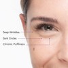 freezeframe revital EYES