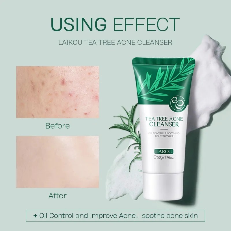 Crema Limpiadora Facial Laikou Para Eliminar Granos