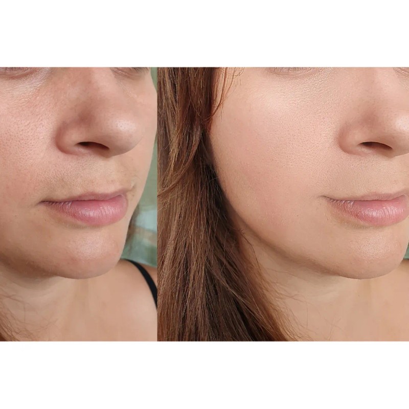 Crema Antiedad Hidratante. Aclarante.antimanchas Vitamina C Todo Tipo De Piel