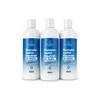 Shampoo Alquitran De La Hulla, Psoriasis Caspa, 3 500ml