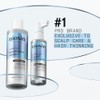 Nioxin Professional Anti-Hair Loss Niacinamide Leave-On Scalp Treatment