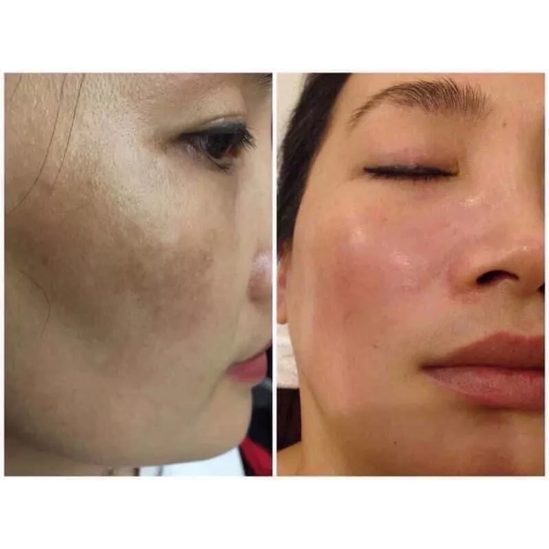 Dr. MH Mela-M Whitening Magic Cream SOLVE YOUR SKIN PROBLEM