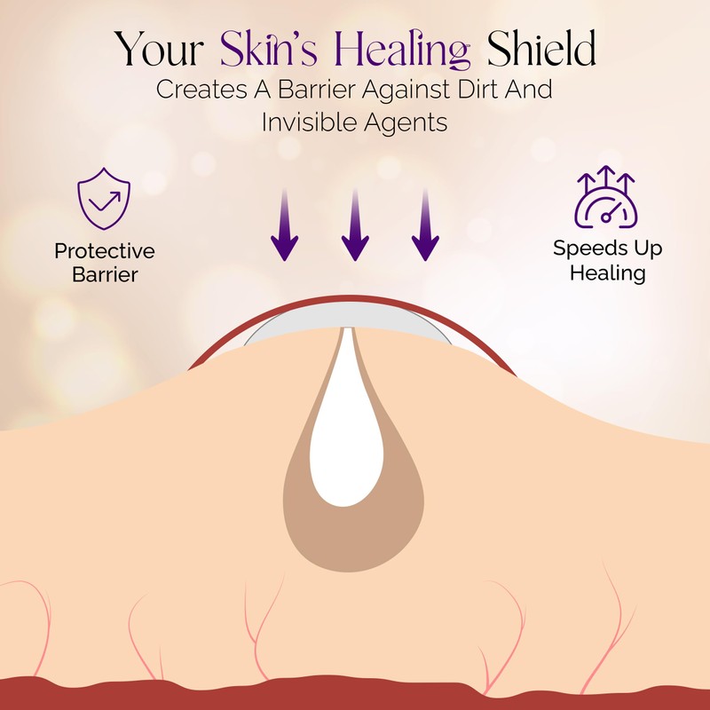 Pimple Patches for Face - Set of 36 Hydrocolloid Pimple