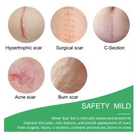Tiras Silicon Medico Reduce Cicatrices Cesárea Reutilizable