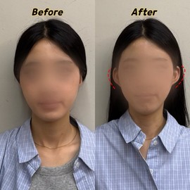 Ear Lift Tape for Droopy Ears (Fairy Ear Style) Transparent 14ea