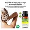 Aceite Esencial De Árbol De Té Antimicotico 100% Natural (10