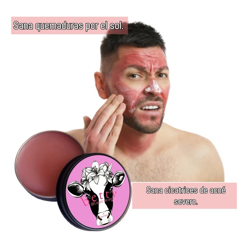 Crema Facial Sebo Res Regeneradora Cicatrizante Rosa Castill Todo Tipo