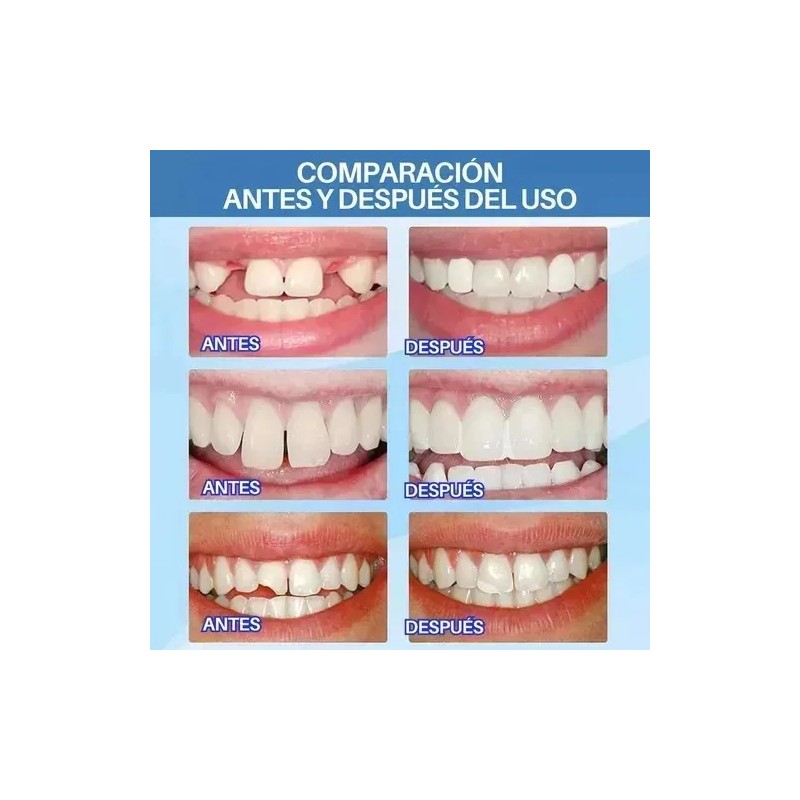 3pcs Perlas Reparación Dientes Postizosdientes Gránulos 30ml