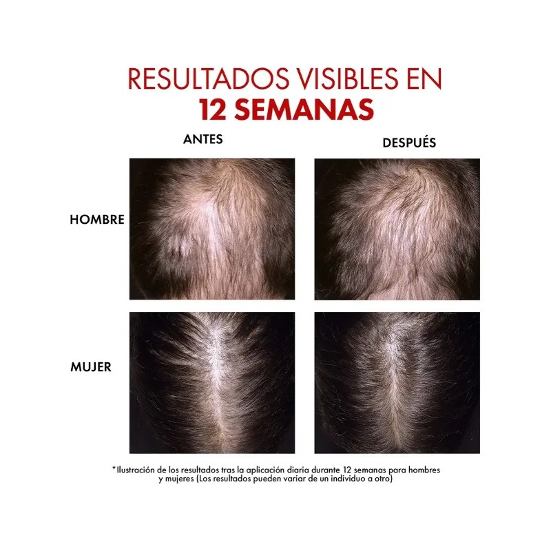 Vichy Dercos Aminexil Clinical Regen Serum 90ml
