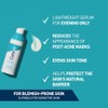 CeraVe Resurfacing Retinol Face Serum for Blemish-Prone Skin, 30ml