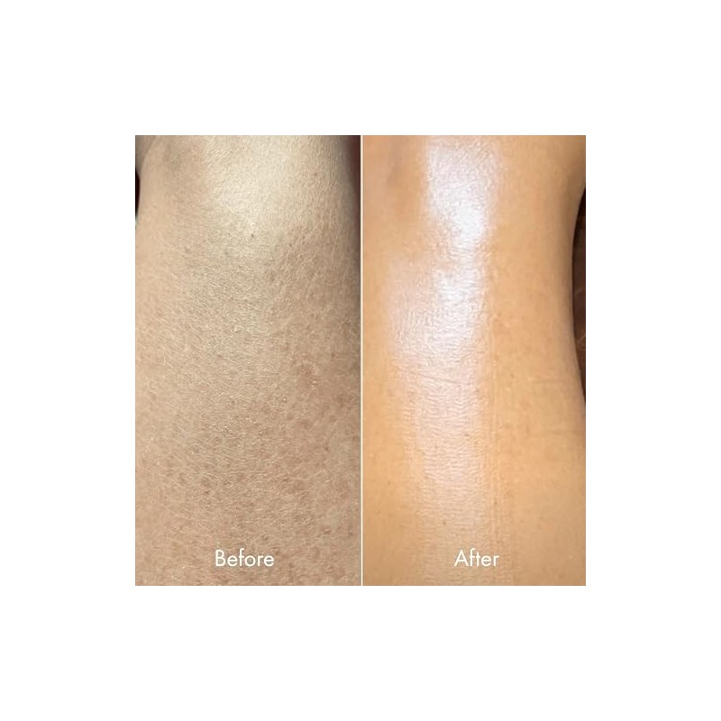 Kopari Ultra Restore Body Butter With Hyaluronic Acid Vitamin And