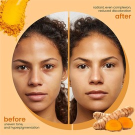 2PCS Turmeric And Ko-jic Acid Soap,Lemon Turmeric & Ko-jic Acid Brightening Soap,Vitamin C For Even Tone & Smooth Glow,Moisturize Firming Pores And Removing Yellow,Deep Cleansing For Body & Face