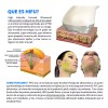 Aqua Aesthetics Mini Hifu V1.0 Radiofrecuencia Ultrasonido Rf Elimina Papada