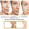 Turmeric Serum, Dark Spot Correcting Serum, Hyperpigmentation Treatment, Dark Spot