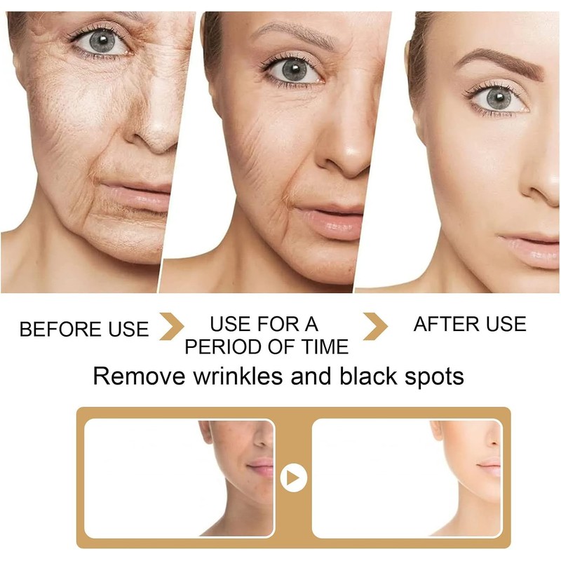 Turmeric Serum, Dark Spot Correcting Serum, Hyperpigmentation Treatment, Dark Spot