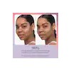 Therabody - TheraFace Depuffing Wand - Cold & Heat Facial