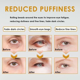 Time Eraser Oil, Time Eraser Roller Ball Castor Oil, Time Eraser Rollerball Castor Oil for Eyes，Castor Oil Frankincense Rollerball，Bags Under Eyes(2 boxe）