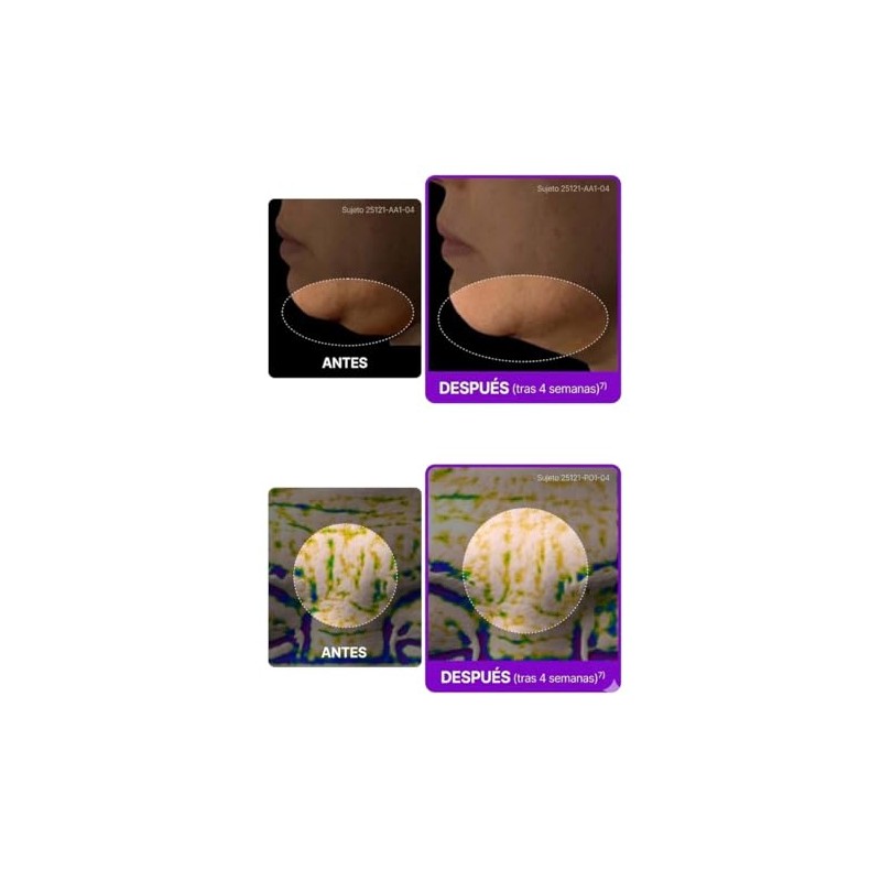 Centellian24 Madeca Cream Tight Lifting Crema Reafirmante Facial con Centella